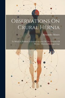 Couverture_Observations On Crural Hernia