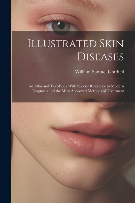 Illustrated Skin Diseases: An Atlas and Text-Book With Special Reference to Modern Diagnosis and the Most Approved Methods of Treatment