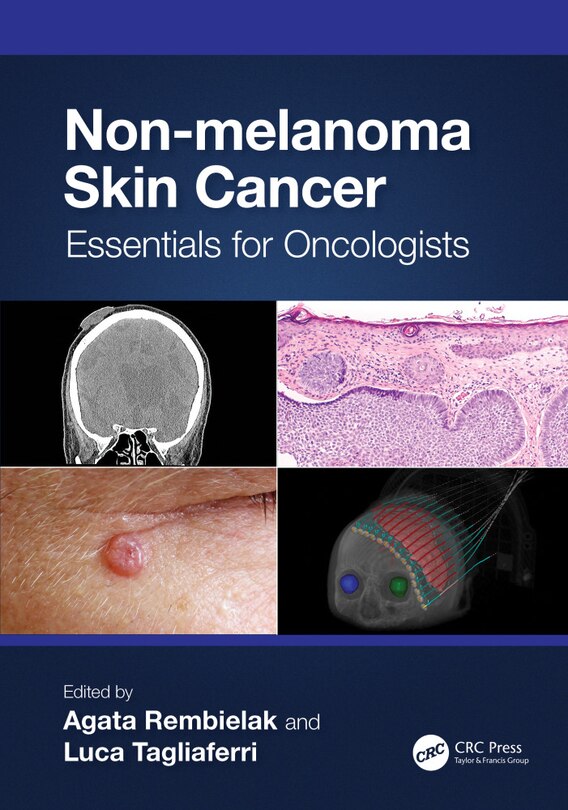 Front cover_Non-melanoma Skin Cancer