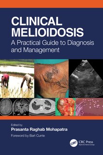 Front cover_Clinical Melioidosis