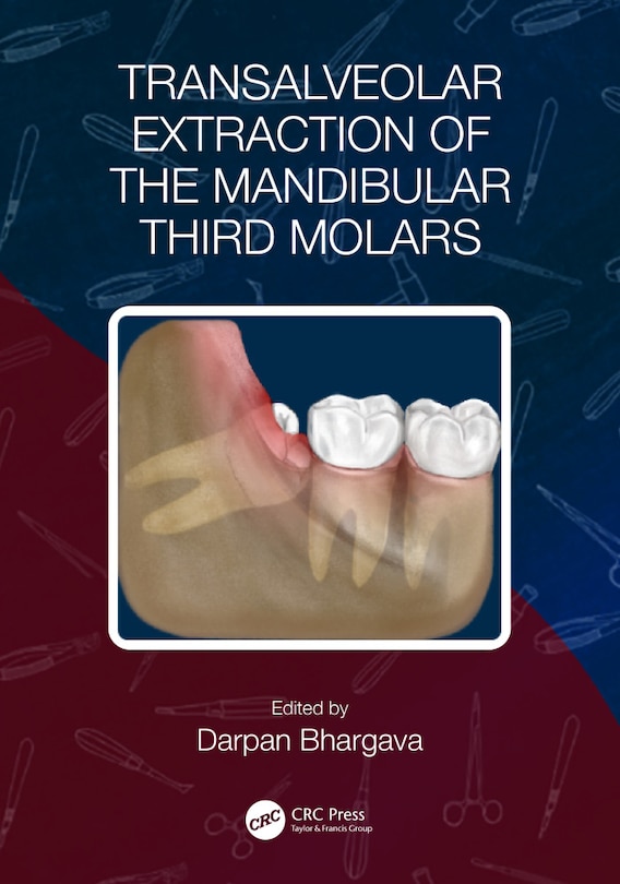 Couverture_Transalveolar Extraction of the Mandibular Third Molars