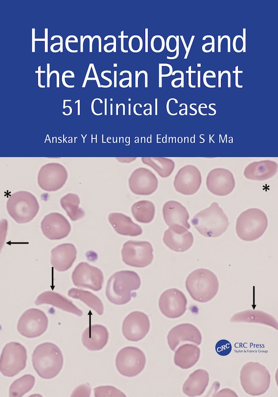 Couverture_Haematology and the Asian Patient
