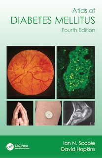 Front cover_Atlas of Diabetes Mellitus