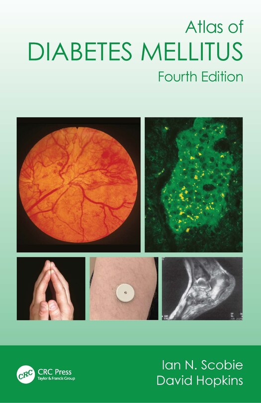 Front cover_Atlas of Diabetes Mellitus