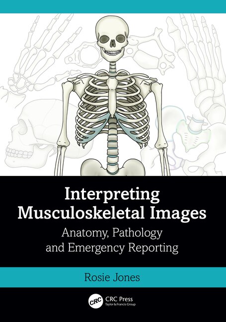 Front cover_Interpreting Musculoskeletal Images