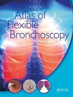 Front cover_Atlas of Flexible Bronchoscopy