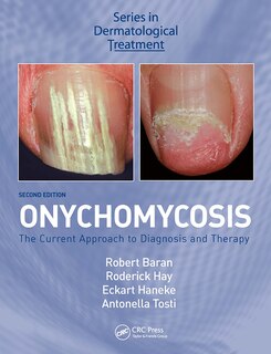 Front cover_Onychomycosis