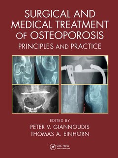 Front cover_Surgical and Medical Treatment of Osteoporosis