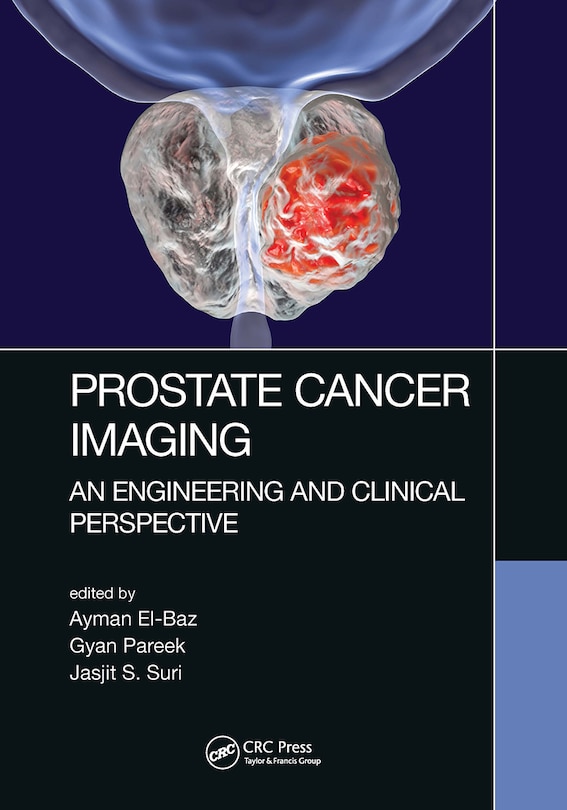 Front cover_Prostate Cancer Imaging