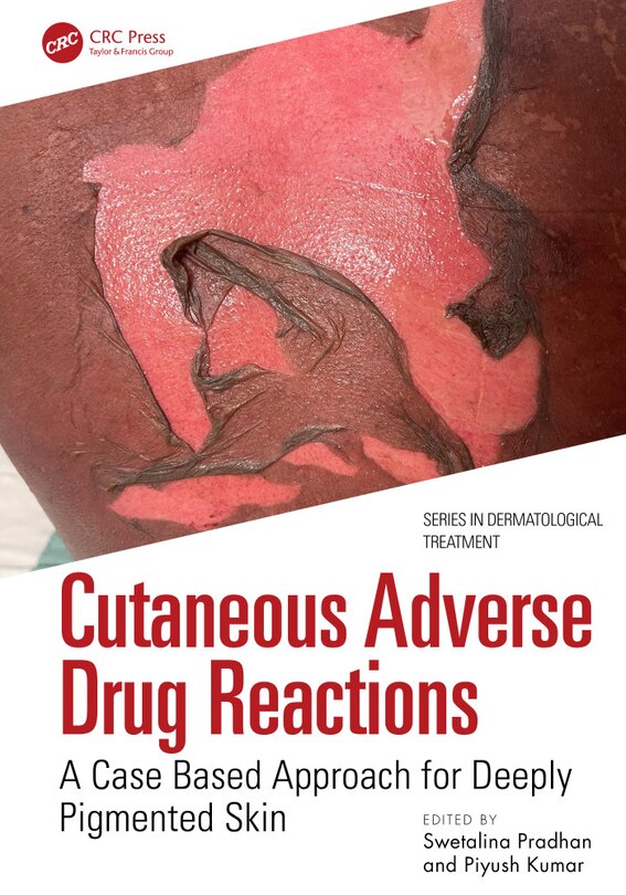 Couverture_Cutaneous Adverse Drug Reactions