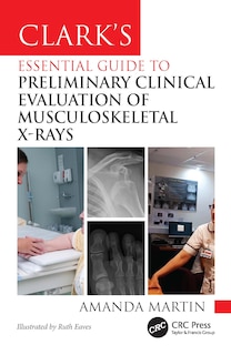 Couverture_Clark's Essential Guide to Preliminary Clinical Evaluation of Musculoskeletal X-rays