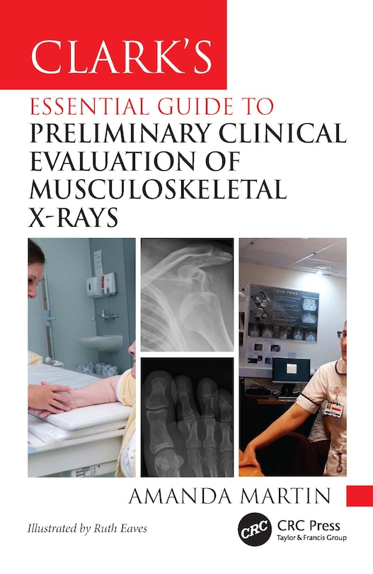 Couverture_Clark's Essential Guide to Preliminary Clinical Evaluation of Musculoskeletal X-rays