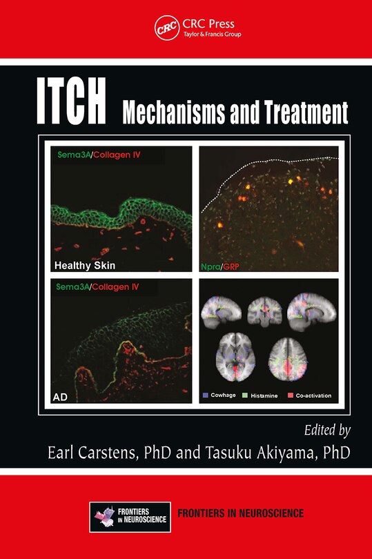Front cover_Itch