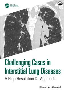 Couverture_Challenging Cases in Interstitial Lung Diseases
