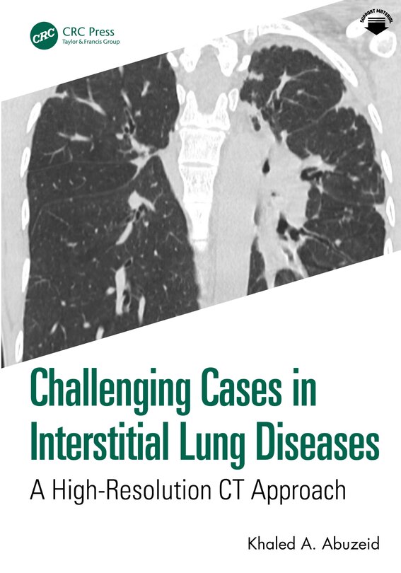 Couverture_Challenging Cases in Interstitial Lung Diseases