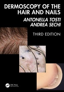Couverture_Dermoscopy of the Hair and Nails