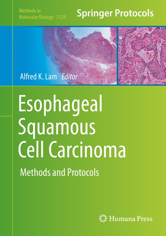 Couverture_Esophageal Squamous Cell Carcinoma