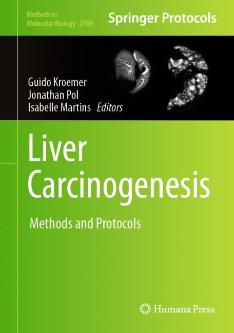 Front cover_Liver Carcinogenesis