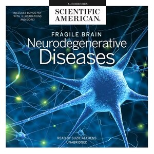 Couverture_Fragile Brain