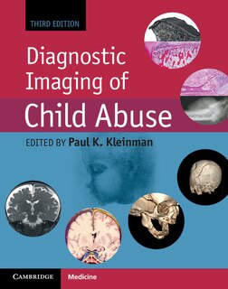 Front cover_Diagnostic Imaging Of Child Abuse