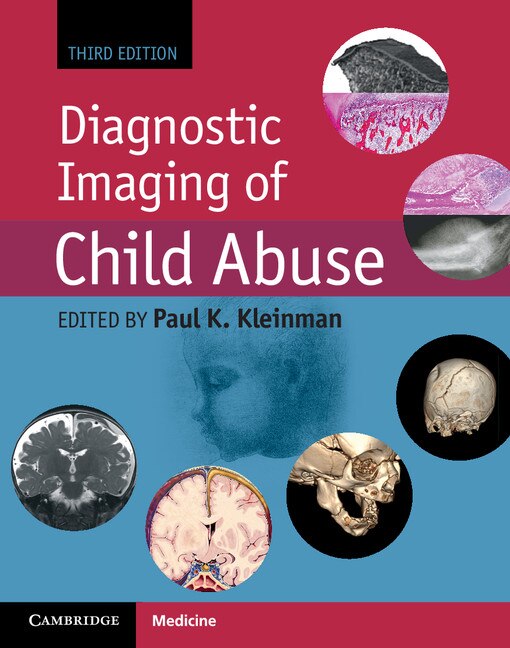 Front cover_Diagnostic Imaging Of Child Abuse