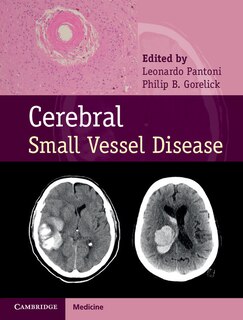 Couverture_Cerebral Small Vessel Disease