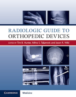 Front cover_Radiologic Guide To Orthopedic Devices