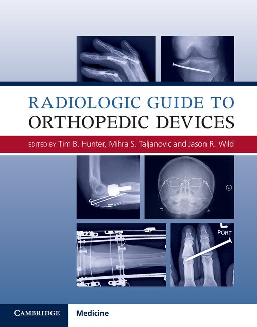 Front cover_Radiologic Guide To Orthopedic Devices