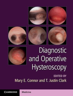 Front cover_Diagnostic And Operative Hysteroscopy