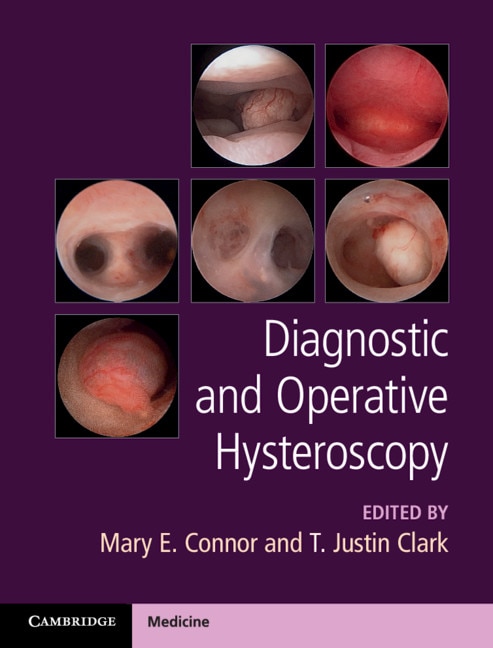 Front cover_Diagnostic And Operative Hysteroscopy
