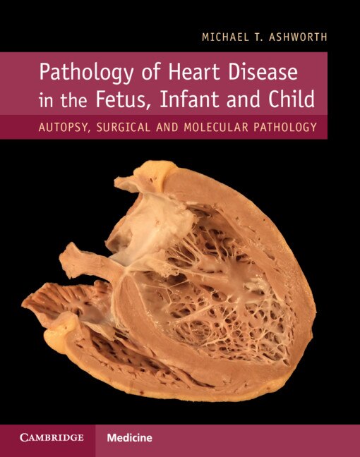 Couverture_Pathology Of Heart Disease In The Fetus, Infant And Child