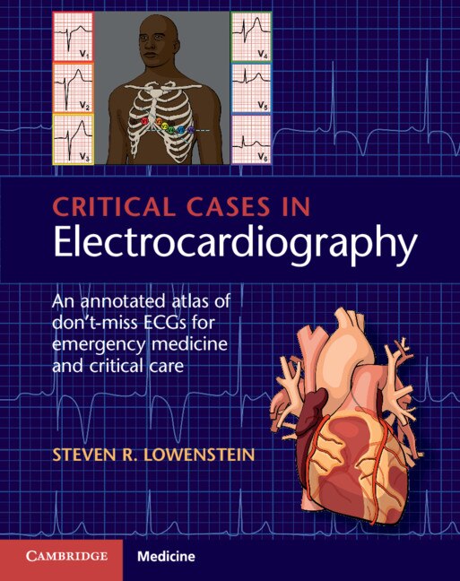 Front cover_Critical Cases In Electrocardiography
