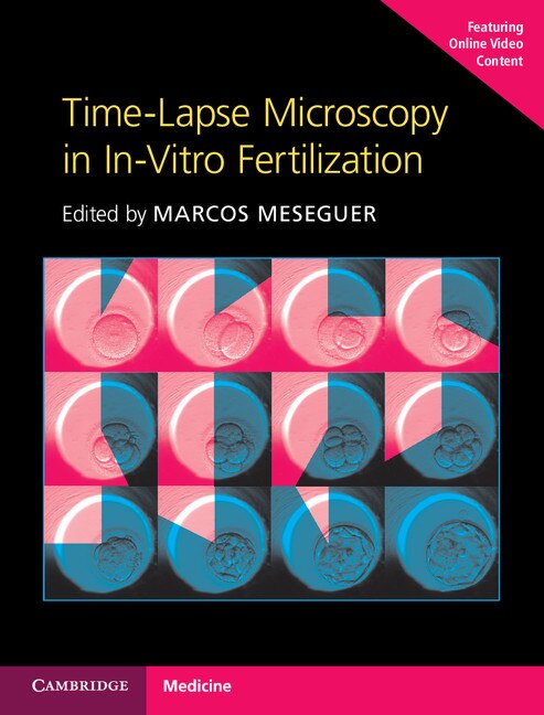 Couverture_Time-lapse Microscopy In In-vitro Fertilization Hardback With Online Resource