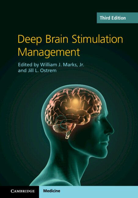 Front cover_Deep Brain Stimulation Management
