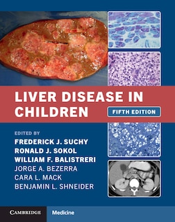 Front cover_Liver Disease In Children