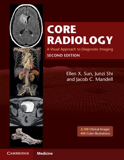 Diagnostic Radiology 7th Ed 1,2巻 Core Radiology: A Visual Approach To Diagnostic Imaging ('bx