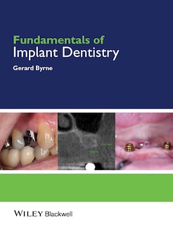Front cover_Fundamentals of Implant Dentistry