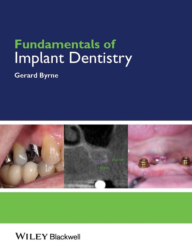 Front cover_Fundamentals of Implant Dentistry