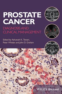 Couverture_Prostate Cancer
