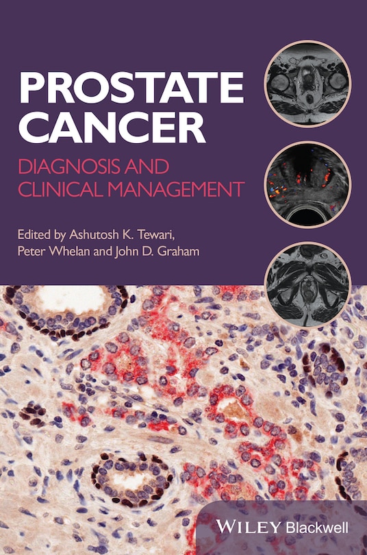 Couverture_Prostate Cancer