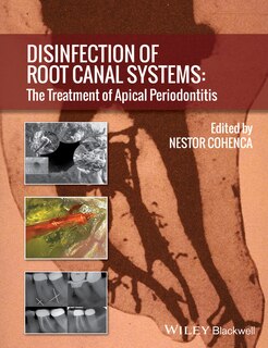 Front cover_Disinfection of Root Canal Systems