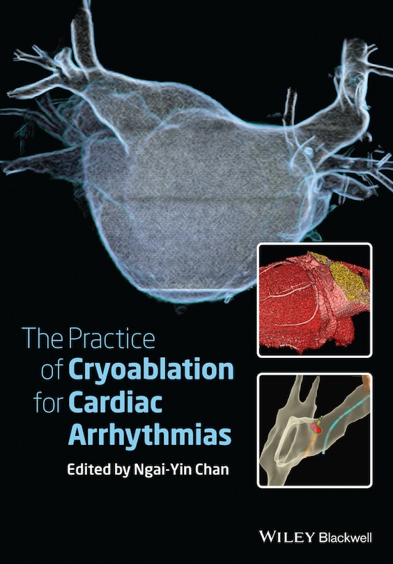 Couverture_The Practice of Catheter Cryoablation for Cardiac Arrhythmias