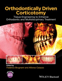 Front cover_Orthodontically Driven Corticotomy