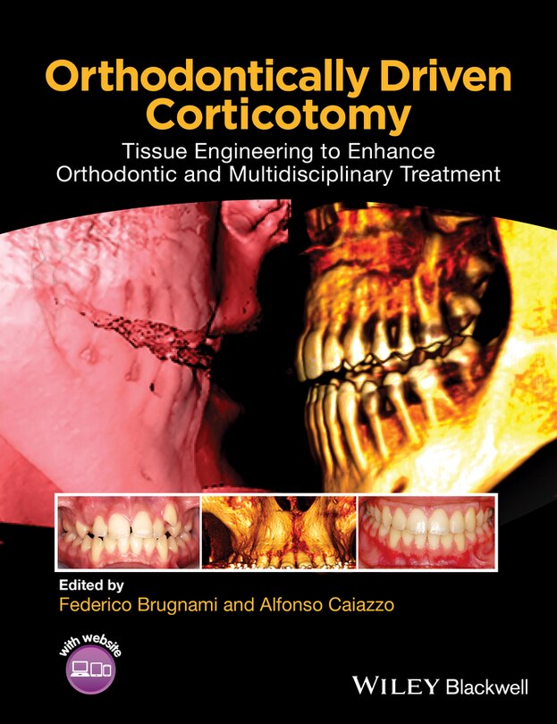 Front cover_Orthodontically Driven Corticotomy