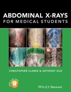 Front cover_Abdominal X-rays for Medical Students