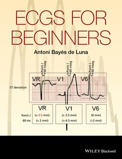 Front cover_ECGs for Beginners