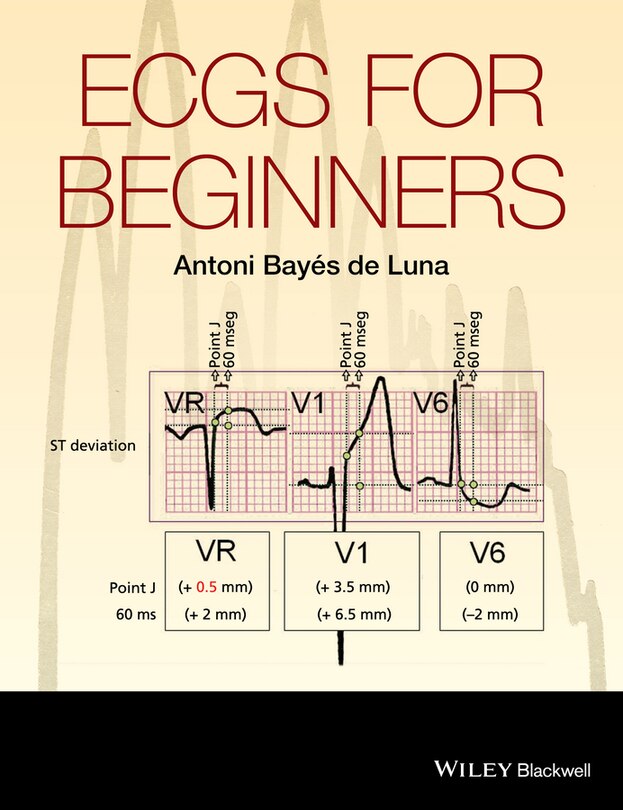 Front cover_ECGs for Beginners