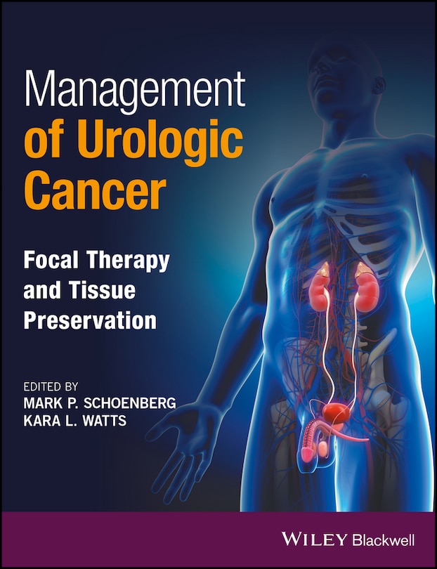 Couverture_Management of Urologic Cancer
