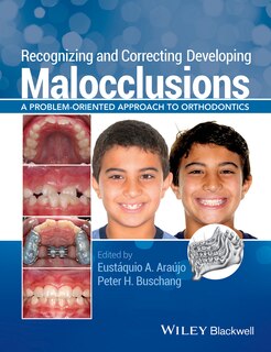 Couverture_Recognizing and Correcting Developing Malocclusions
