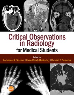 Front cover_Critical Observations in Radiology for Medical Students